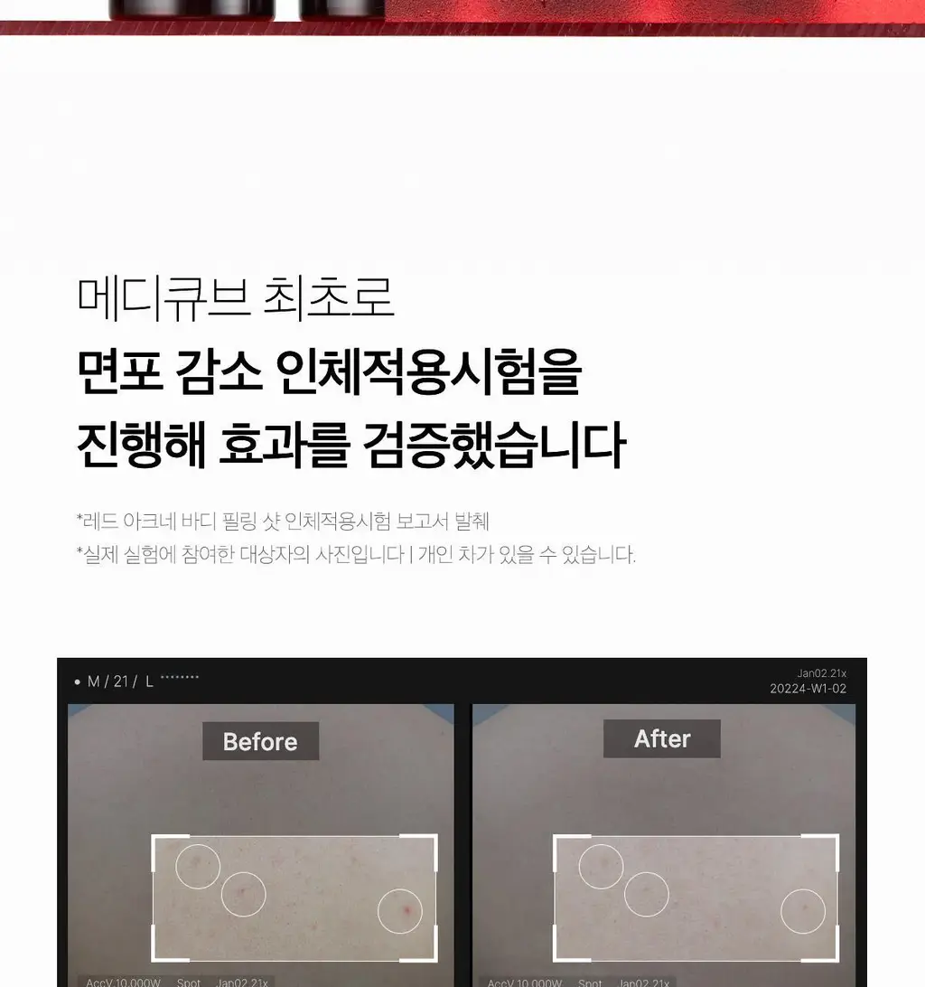 [NEW/바디트러블 케어] 메디큐브 레드 아크네 바디 필링 샷 110g 상세페이지 12